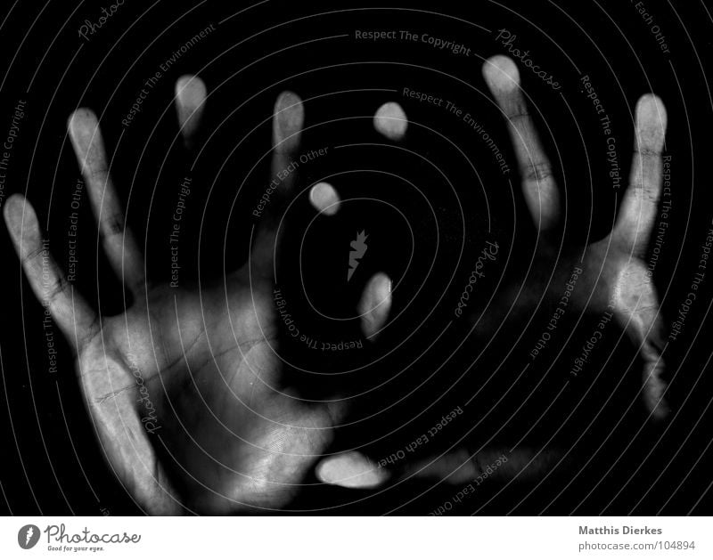 RÖNTGEN Röntgenstrahlen Scanner erfassen gebrochen brechen Unfall Sportunfall Diagnostik Gleise Verbundenheit gefährlich Hand Finger Daumen Röntgenbild Angst