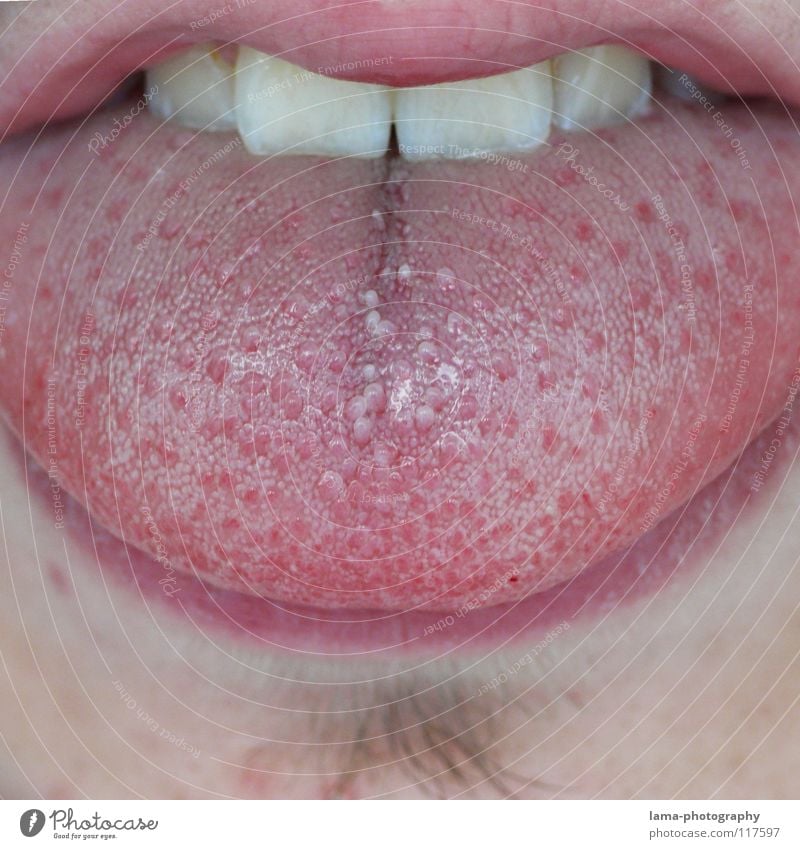Doktorspielchen Lippen rosa rot Bart Geschmackssinn Ernährung Sinnesorgane Schleimhaut trocken feucht nass sprechen Bakterien Zahnarzt untersuchen Makroaufnahme