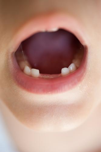 Zahnlücke bei Kindergartenkind Süßwaren schön Gesundheit Gesunde Ernährung Schulkind Arzt Zahnarzt Mensch maskulin feminin Mädchen Junge Kindheit Mund 1