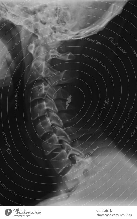 Röntgenaufnahme von Hals und Nacken Körper Gesundheitswesen Wissenschaften Mensch Mann Erwachsene 1 30-45 Jahre schwarz Radiologie Scan medizinisch Skelett