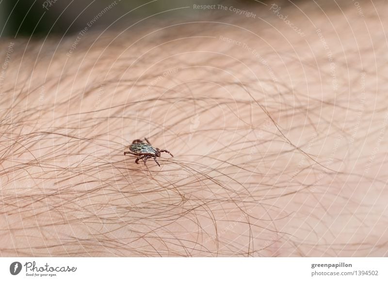 Zecke läuft über menschliche Haut Natur Garten Park Wiese Behaarung Insekt FSME Frühsommermeningitis Meningitis Frühsommer-Meningoenzephalitis borreliose