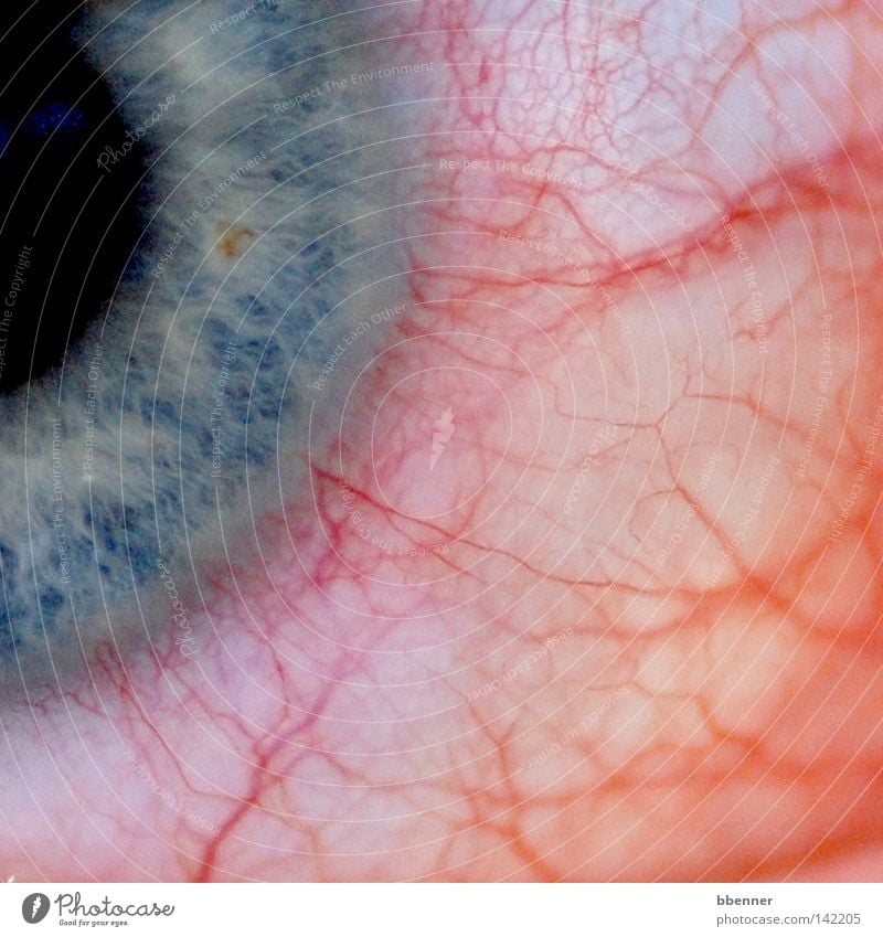 Juckreiz Auge Regenbogenhaut Gefäße Äderchen blau schwarz rot weiß Allergie Schmerz unbequem nerven Störung Gesundheitswesen Detailaufnahme jucken geschwollen