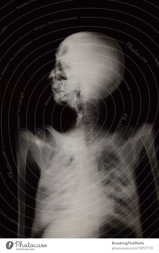 Röntgenuntersuchungs-Röntgenogramm des menschlichen Skeletts Gesundheit Gesundheitswesen Behandlung Medikament Wissenschaften Krankenhaus Technik & Technologie