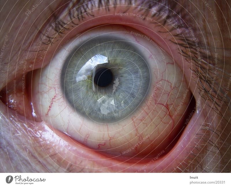 Blutauge Konjunktivitis Gefäße rot Mann Auge Regenbogenhaut Augenheilkunde
