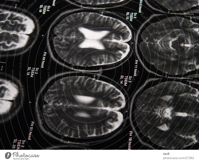 Kernspinserie Nr.1 Gehirn u. Nerven Elektrisches Gerät Technik & Technologie Schädel durchleuchten Kopf Fotografie Kernspintomographie Diagnostik Röntgenbild