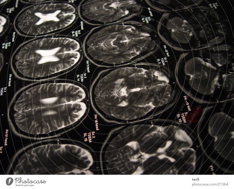 Kernspinserie Nr.2 Gehirn u. Nerven Elektrisches Gerät Technik & Technologie Schädel durchleuchten Kopf Fotografie Kernspintomographie Diagnostik Röntgenbild
