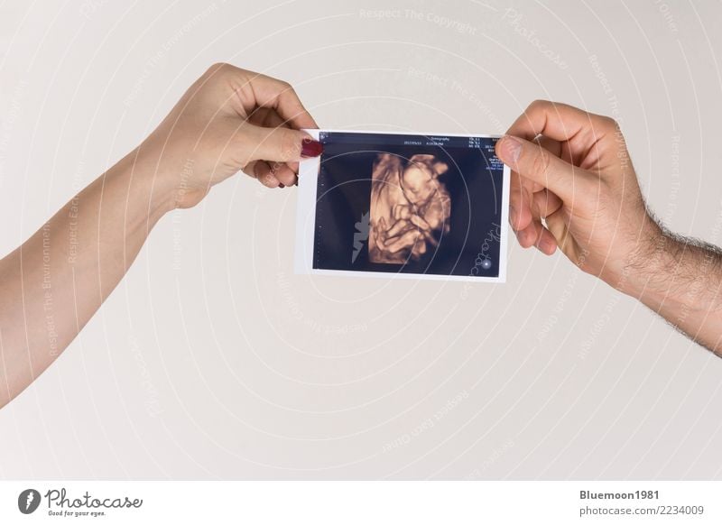 Elternteil, das ungeborenes Baby Sonography-Bild in den Händen hält Medikament Leben Kindererziehung Wissenschaften Technik & Technologie Mensch Frau Erwachsene