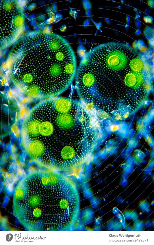 Mikrokosmos Umwelt Pflanze Sommer exotisch Algen Volvox Teich Schwimmen & Baden elegant rund schön blau gelb grün schwarz Mikrofotografie Mikroskop Farbfoto