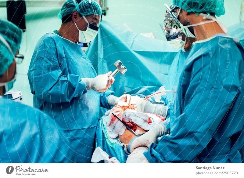 Team von operierenden Chirurgen. Operation Chirurgie in Betrieb befindlich chirurgisch Krankenhaus Wunde Prothesen Blut Knochen orthopädisch Implantat offen