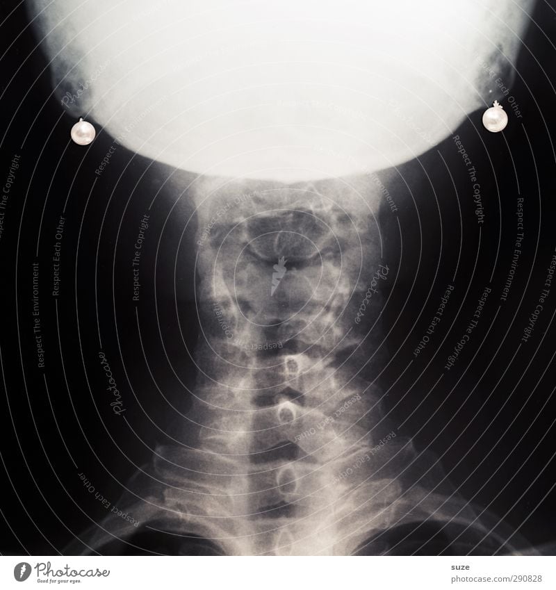Glamour Girl elegant Stil Gesundheitswesen Arzt Ohrringe außergewöhnlich lustig verrückt schwarz weiß Röntgenbild Perle edel Skelett Wirbelsäule Anatomie