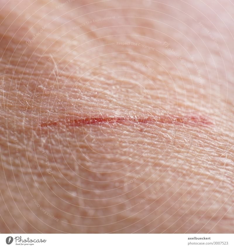 Haut mit Kratzer oder Schramme Gesundheitswesen Mensch Erwachsene 1 authentisch Wunde Schnittwunde Kruste klein Farbfoto Nahaufnahme Detailaufnahme