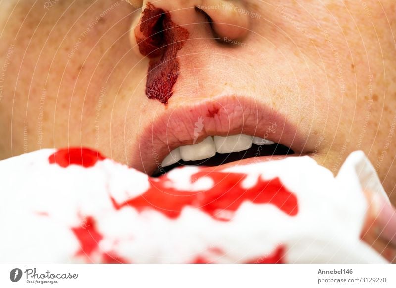 Wunde Nasenbluten, Frau blutet aus der Nase. Körper Haut Gesicht Gesundheitswesen Krankheit Medikament Erholung Mensch Erwachsene Mund Tropfen klein rot weiß