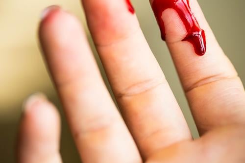 Fingerschnitt, Blutung verletzt mit Messer Körper Haut Gesundheitswesen Medikament Krankenhaus Mensch Frau Erwachsene Hand Tropfen rot weiß Schmerz Entsetzen