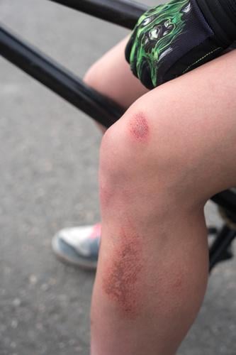 Schürfwunde Skateplatz Fahrradfahren Mensch Kind Leben Beine 1 Wege & Pfade kaputt sportlich Tapferkeit Coolness Leidenschaft Sicherheit Hoffnung Sorge