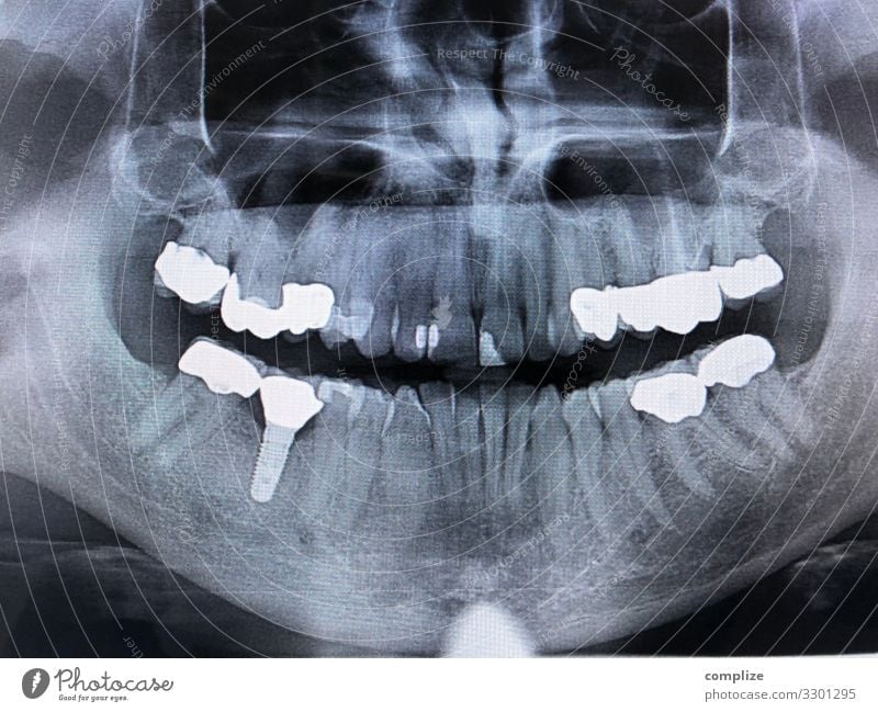 Baustelle Gesundheit Gesundheitswesen Behandlung Wohlgefühl Berufsausbildung Arzt Arbeitsplatz Mann Erwachsene gruselig Schmerz implantat Zahnersatz plombe