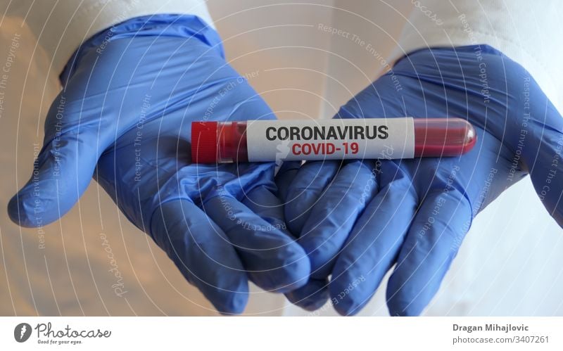 Blut auf Corona-Virus testen 2019-ncov Analyse Analysieren Biogefährdung Biologie Bluttest Blutröhrchen Pflege China klinisch Coronavirus Coronavirus-Krankheit