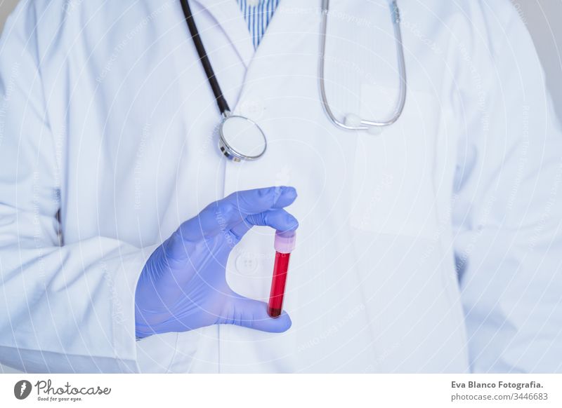kaukasischer Arzt Mann hält Reagenzglas mit Blut für 2019-nCoV-Analyse. Chinesisches Coronavirus-Bluttestkonzept. Covid-2019 covid 2019 Prüfung Kaukasier
