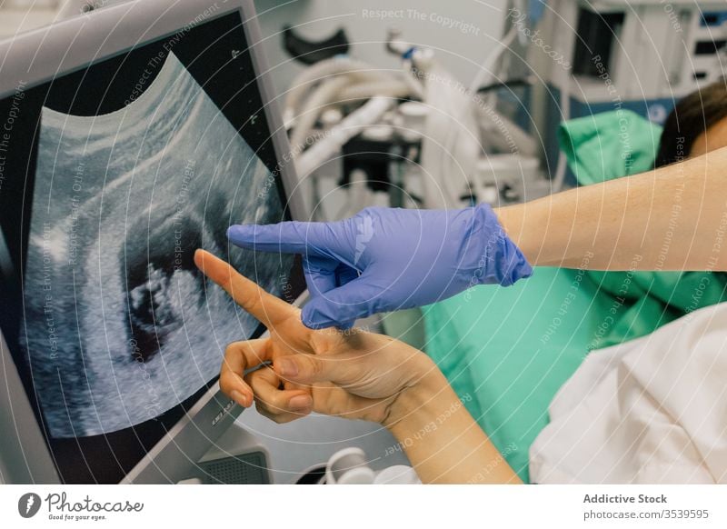 Pflanzengynäkologe zeigt anonymen weiblichen Patientenembryo am Computerbildschirm Frauenarzt Embryo Monitor zeigen medizinisch Gerät Klinik Ultraschall Prüfung