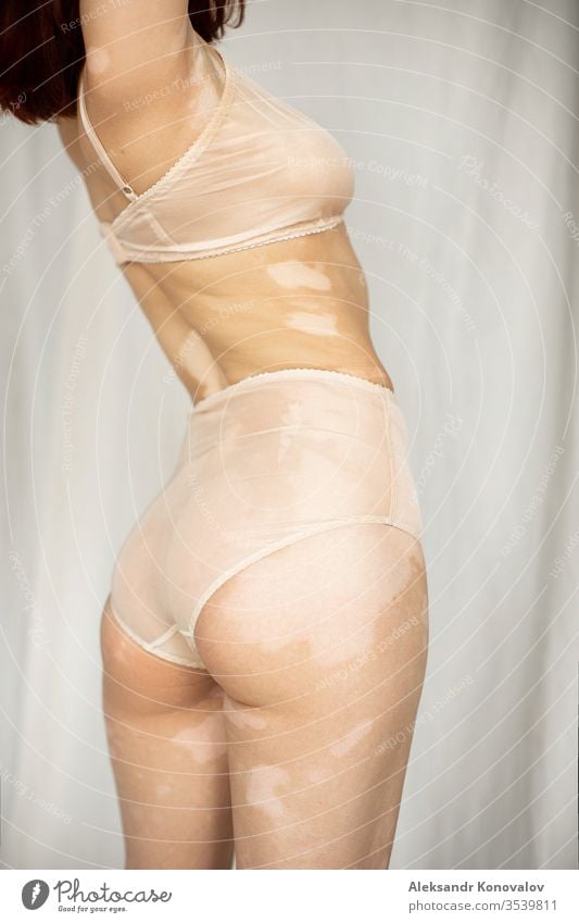 Junge Frau mit blasser Haut und Vitiligo steht auf Stoffhintergrund im natürlichen Licht in transparenter Unterwäsche Körper Schönheit schlank schön weiß nackt