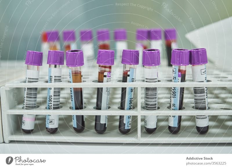 Blutreagenzgläser im medizinischen Labor Tube Prüfung Probe Flasche Kulisse Medizin Gesundheitswesen Container Krankenhaus forschen Wissenschaft Klinik Analyse