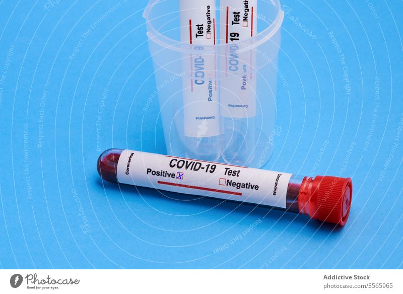 Satz positiv markierter COVID 19-Blutprobenröhrchen Coronavirus Prüfung COVID19 Diagnostik Medizin Tube Gesundheitswesen forschen Analyse Container messen