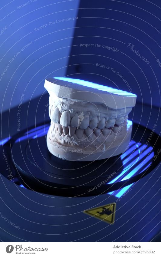 Zähne in moderner Klinik gegossen Zahnarzt gießen Prothesen Zahnersatz Arbeit dental medizinisch Stomatologie Zahnmedizin Gerät Instrument Werkzeug Medizin
