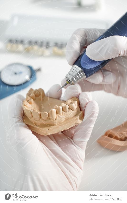 Metall medizinische Gegenstände des Zahnarztes auf blauem Hintergrund - ein  lizenzfreies Stock Foto von Photocase
