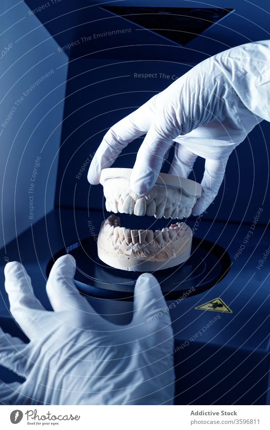 Zahnarzt, der in der Klinik mit gegossenen Zähnen arbeitet gießen Prothesen Zahnersatz Arbeit dental medizinisch Stomatologie Zahnmedizin Gerät Instrument