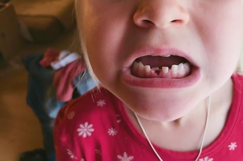 lieblingsmensch | mit biss! Zähne Milchzähne Gebiss beissen Detailaufnahme Nahaufnahme Mund Zahnlücke neu beißen Zahnarzt Gesundheit Zahnpflege Gesundheitswesen