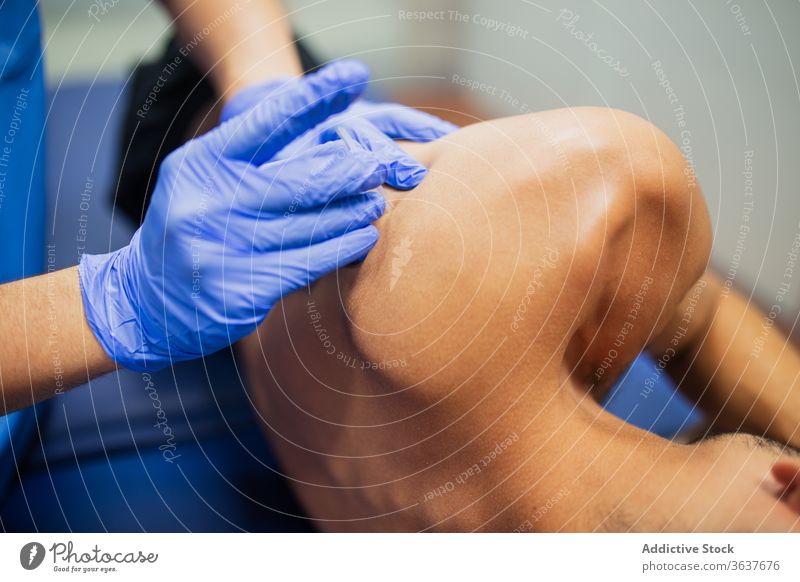 Unbekannter Arzt schießt einem anonymen Sportler eine Nadel in den Rücken einstecken geduldig Bein Akupunktur Behandlung Verfahren steril Handschuh