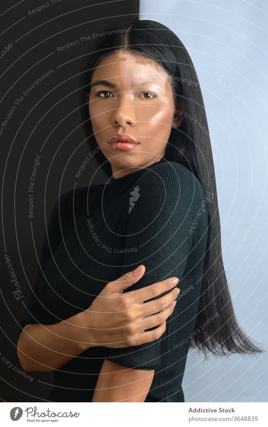 Ethnisches Modell mit Vitiligo, das zu Hause an der Wand steht Haut Voraussetzung emotionslos Krankheit sinnlich Schönheit verführerisch Frau Harmonie feminin