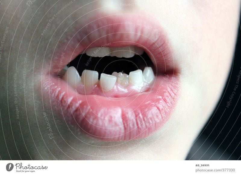 Zahnspange? Kind Mund Lippen Zähne 1 Mensch 3-8 Jahre Kindheit authentisch eckig neu Spitze weiß Gesundheit Gesundheitswesen Körperpflege Präzision Wachstum