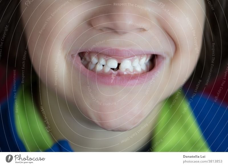 Sturz des ersten Zahnes des Babys abwesend Kaukasier Kindheit Sauberkeit Nahaufnahme fallen erste Zähne Glück Gesundheit Hygiene Schneidezähne unvollendet