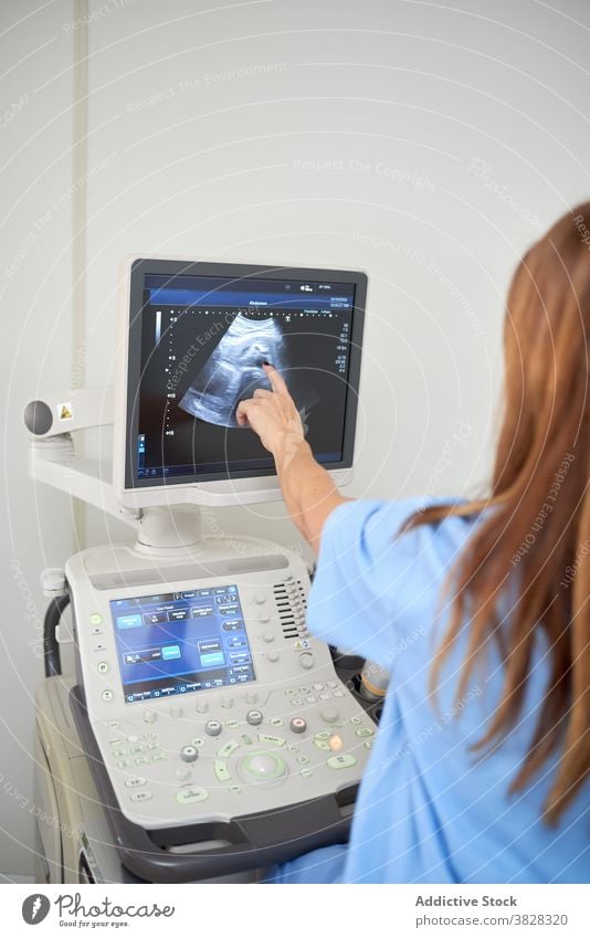Anonymer Ultraschalltechniker, der auf den Monitor des Scanners in der Klinik zeigt Techniker zeigen Sonographie Diagnostik Video Gerät Frauen Arzt Maschine