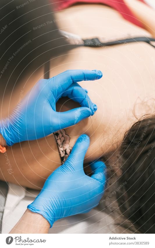 Crop Arzt tun Akupunktur Verfahren in der Klinik Therapie Nadel Schmerz Erleichterung Wiederherstellung Rehabilitation geduldig Therapeut Leckerbissen