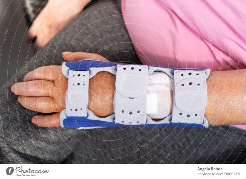 Neu operierter gebrochener Arm in einer Schiene schienen Arme Medizin Schmerz menschlich geduldig Unfall Pflege wehtun Fraktur medizinisch Knochen Chirurgie