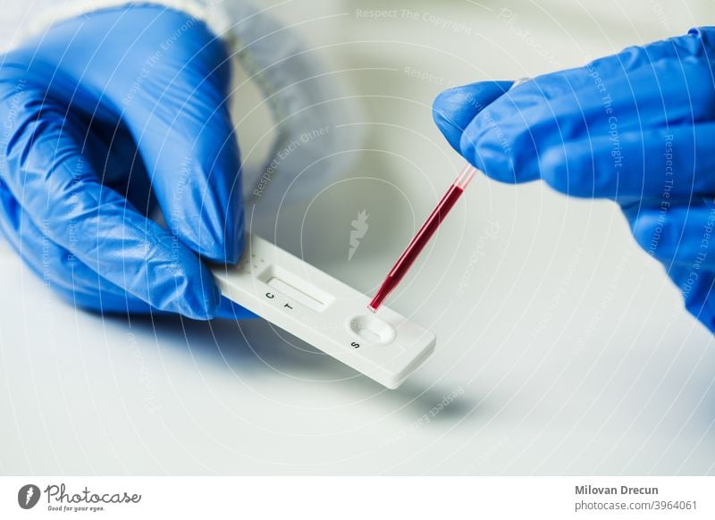 Wissenschaftler oder Arzt, der die Blutprobe auf den Rapid Diagnostic Rest legt 2019-ncov Analyse Antikörper Antigen Pflege Zelle Cholesterin Klinik Kontrolle