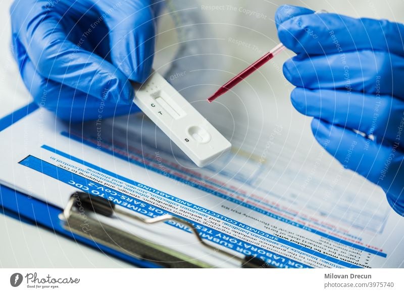 Laborwissenschaftler, der einen diagnostischen Schnelltest durchführt 2019-ncov Analyse Antikörper Antigen Probe Blut Kassette Zelle Rekonvaleszent Korona
