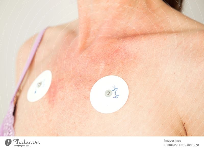 Vergessene EKG-Elektroden an einer Frauenbrust nach der Behandlung. Seitenansicht FrauenbrustBrust Stimulation Technologie Test Therapie Krankenhaus Impuls