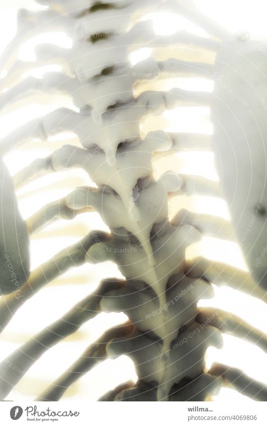 viel Wirbel um nix. Wirbelsäule Rippen Skelett Anatomie Rücken Skoliose Kyphose Verkrümmung Rückgrat verbiegen Gerippe
