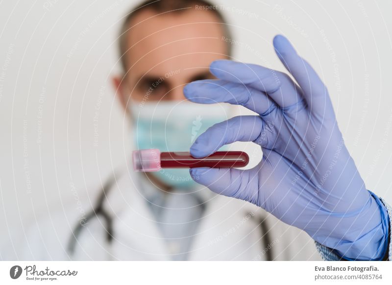kaukasischer Arzt hält Reagenzglas mit Blut für 2019-nCoV-Analyse. Chinese Corona Virus Bluttest Konzept Impfstoff Prüfung Tube forschen bakterielle Porträt