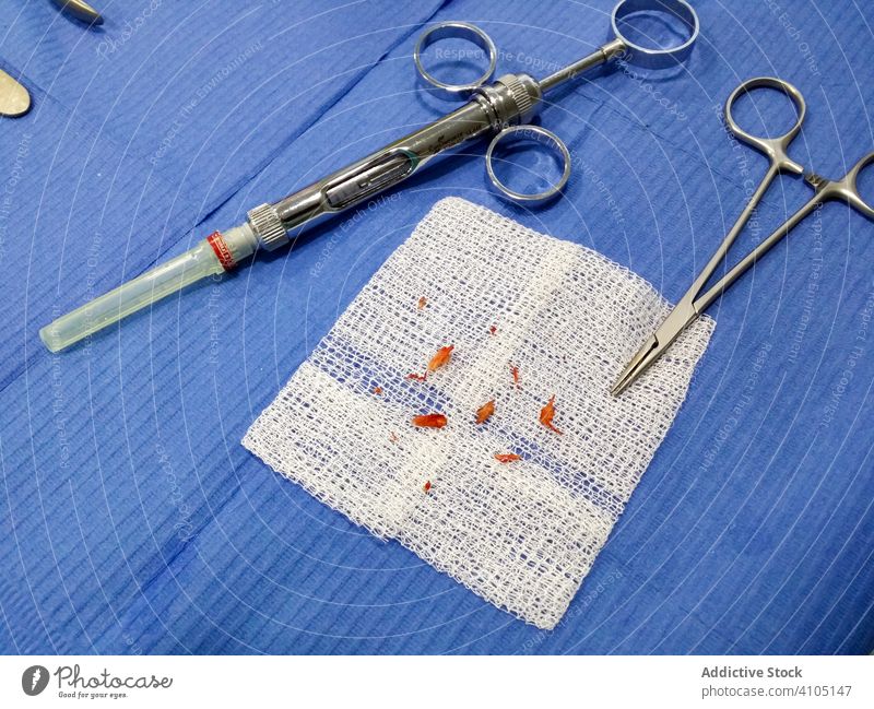 In der Chirurgie Fremdkörperstücke aus den Füßen entfernt Medizin Operation Gerät steril Instrument blutig Fingernagel Verfahren Krankenhaus Werkzeug Gaze