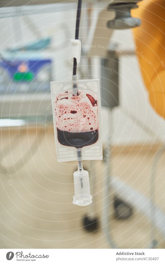 Bluttransfusionsbeutel im Krankenhaus Transfusion schenken Spender Tasche medizinisch Hämatologie Verfahren Gesundheitswesen Prozess Selbstlosigkeit Klinik