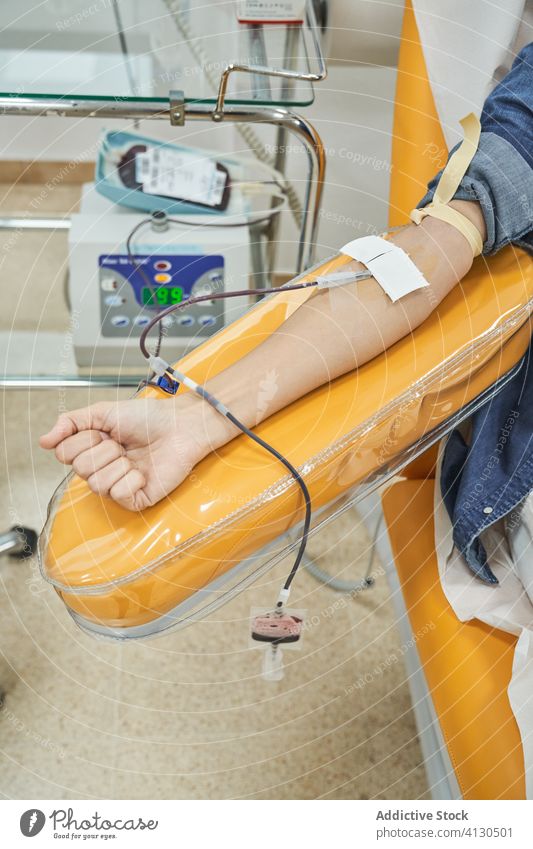 Patient während der Blutspende schenken Spender Frau Hand medizinisch Transfusion Hämatologie Krankenhaus Selbstlosigkeit Freiwilliger Verfahren geduldig Klinik