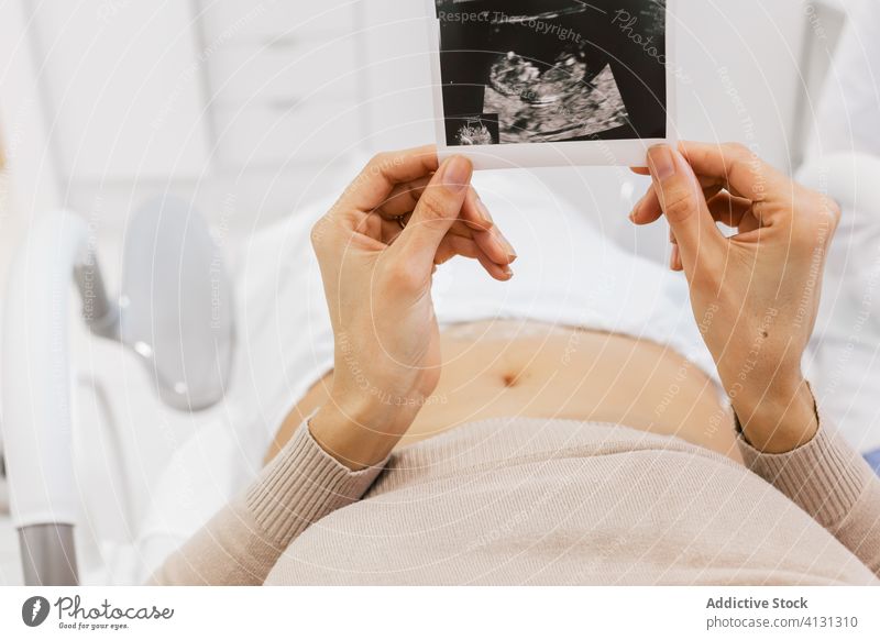 Schwangere Frau bei der Ultraschalluntersuchung Sonogramm Scan untersuchen Klinik fruchtbar Station Schwangerschaft Bett Lügen geduldig modern Bild schwanger