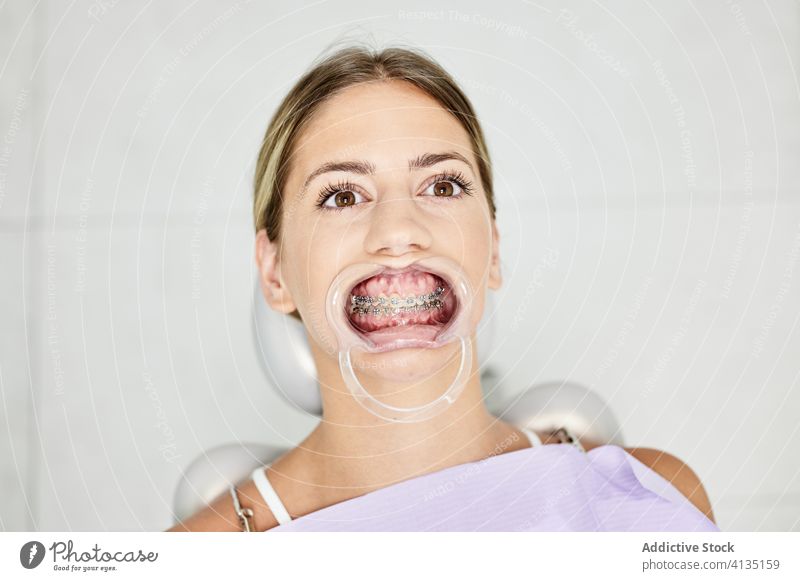 Weiblicher Patient mit zahnärztlichem Retraktor Frau dental Zahnspange Klinik Aufroller Absetzer Krankenhaus Leckerbissen Pflege Licht Öffner Gerät mündlich