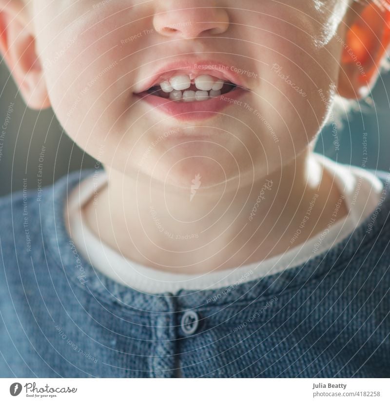 Kleinkind mit Zahndurchbruch; vier Zähne oben und unten zahnend dental Lächeln obere Zähne untere Zähne Kind weiß Sauberkeit Lippen Kauen Biss unabhängig