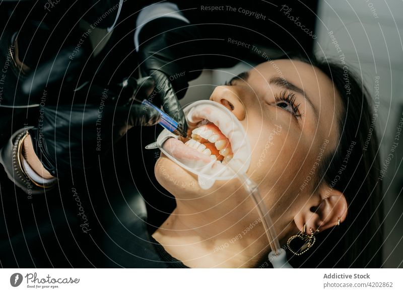 Zahnarzt setzt lichtempfindliche Paste bei der Zahnbehandlung ein dental Kur Licht Leckerbissen Zähne mündlich Verfahren Stomatologie Instrument Klient
