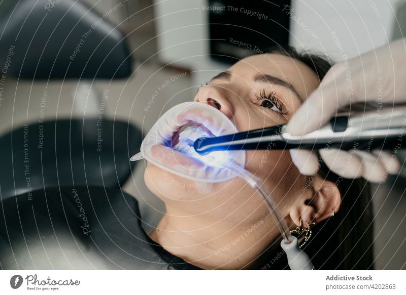 Zahnarzt bei der Zahnbehandlung mit dem Lichthärtungsgerät dental Kur Leckerbissen Zähne ultraviolett uv mündlich Verfahren Stomatologie Instrument Klient