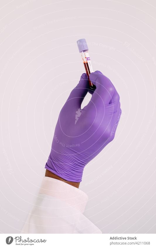 Arzt mit Latexhandschuh zeigt Fläschchen mit Blutprobe Handschuh Analyse medizinisch Krankenhaus steril Labor sanitär Diagnostik Flasche Reagenzglas Ampulle